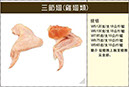 1158三節翅